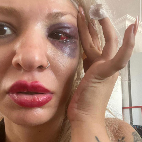 Yüzyüzeyken Konuşuruz'un gitaristine darp soruşturması