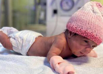 515 gram doğan Elif bebek, hayata tutundu