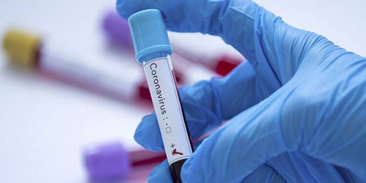 Covid-19'da pozitiflik oranı yüzde 30'lara ulaştı