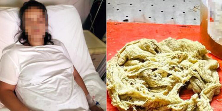 Doğumda vücudunda unutulan gazlı bez, ameliyatla alındı