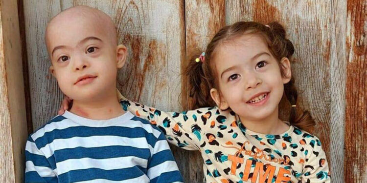 Down sendromlu Alperen, lösemiyle mücadele ediyor