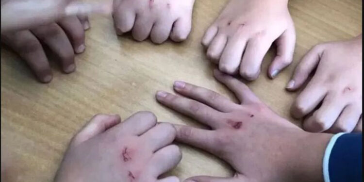 Kanlı para oyunu, saldırgan tutumlara neden oluyor