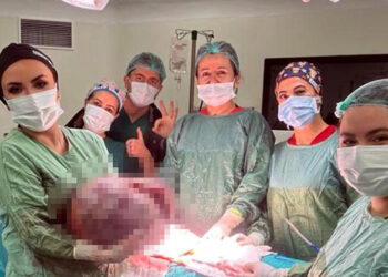 Karın şişliği için gitti, vücudundan 20 kiloluk kitle çıkarıldı