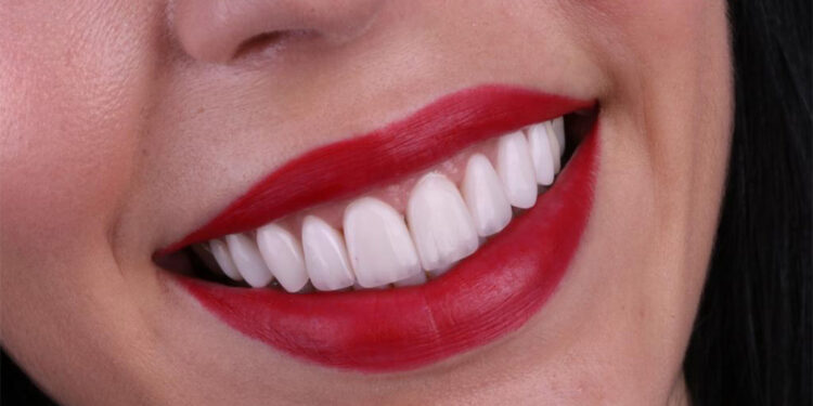 Diş gıcırdatmak yüzü yaşlandırıyor
