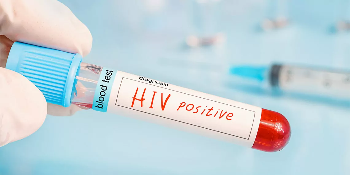 36 bin civarında hiv pozitif kişi var