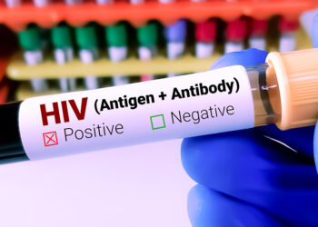 36 bin civarında HIV pozitif kişi var