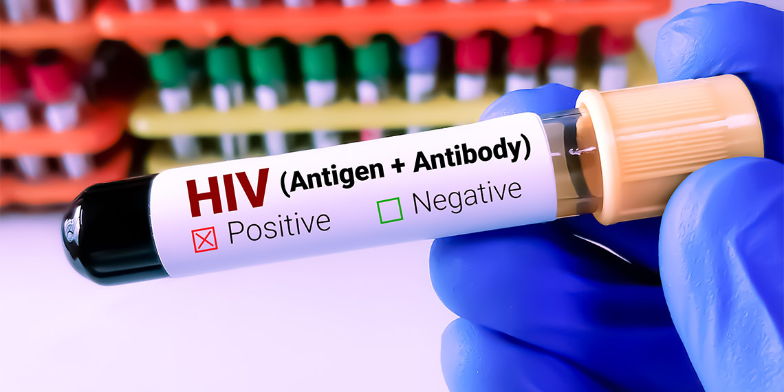 36 bin civarında HIV pozitif kişi var