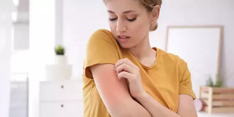 Kliniklerdeki uyuz vakaları yüzde 25’e yükseldi