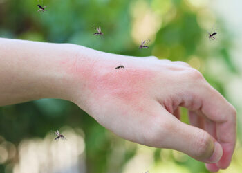 Murray Valley ensefaliti hastalığı hakkında