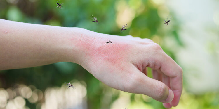 Murray Valley ensefaliti hastalığı hakkında