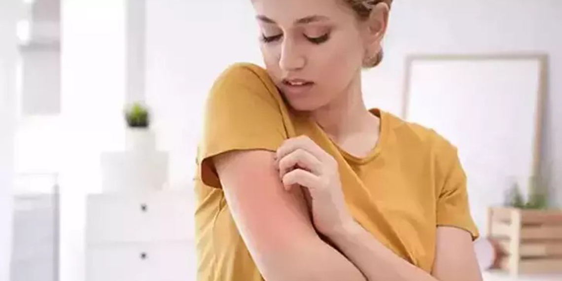 Uyuz vakaları arttı; gece kaşıntısıyla başlıyor