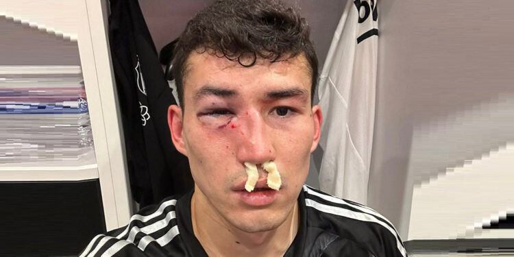 Bakhtiyor Zaynutdinov hastaneye kaldırıldı