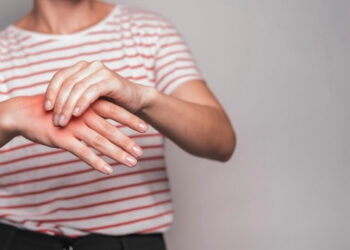 Artrit hastalığı hakkında