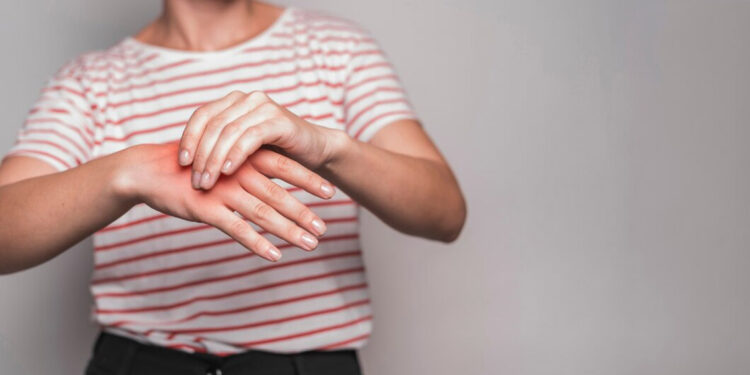 Artrit hastalığı hakkında