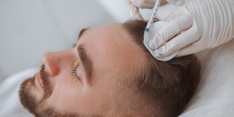 Eksozom tedavisi saç ekim işleminin başarısını yükseltiyor