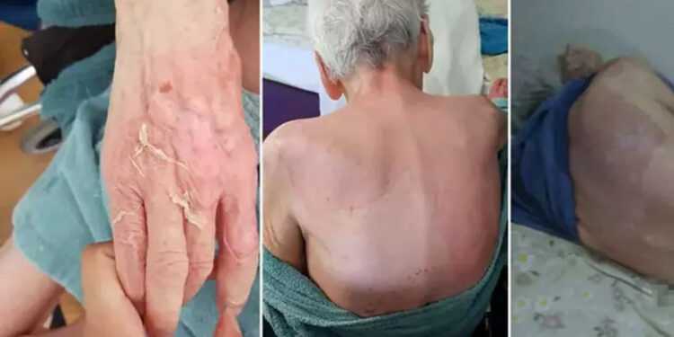 Huzurevindeki banyo sonrası ölümde 2 kişiye hapis cezası