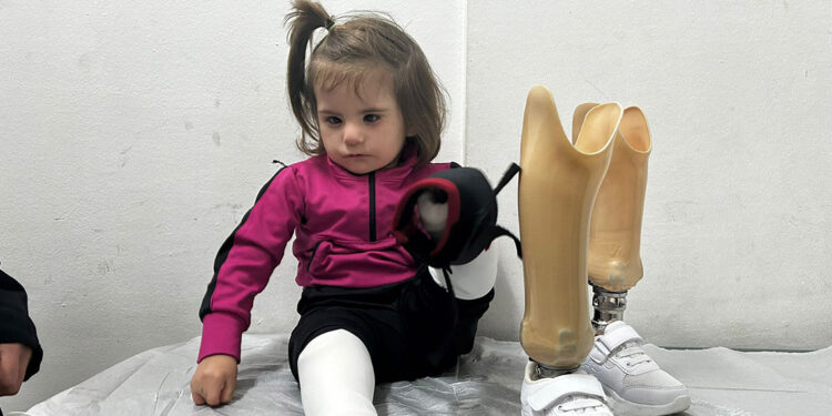 Kolu ve bacakları olmayan Tali, protezlerine kavuştu