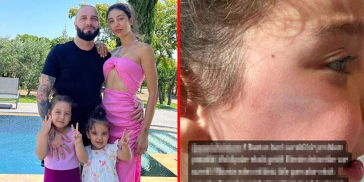 Şarkıcı Berkay kızının üzerine düşen mobilya için dava açtı