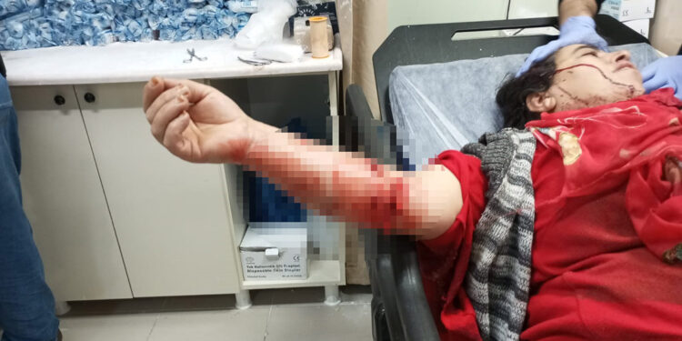 Yasaklı ırk köpeğin saldırısına uğrayan kadın yaralandı