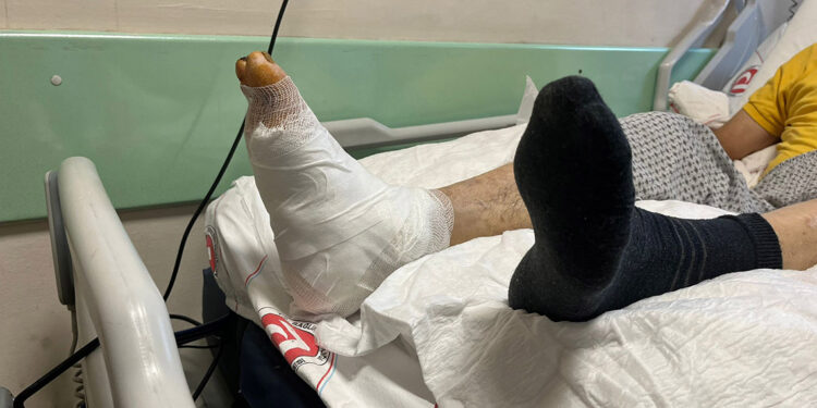 Diyabetik yaralarda uzuv kayıpları, engellenebilir