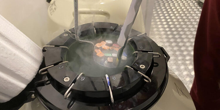 Tüp bebek tedavisinde yapay zeka ile yüzde 90 başarı oranı