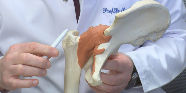 Yılda yaklaşık 170 bin kişide kalça kırığı meydana geliyor