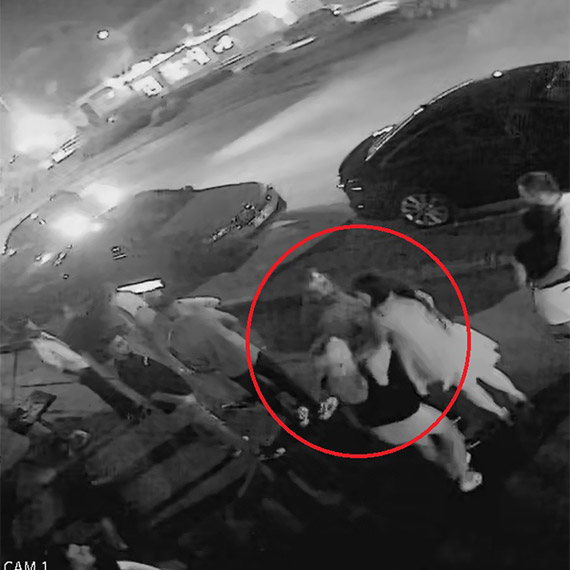 Sibel Kahraman 2022 yılında ayrıldığı eski sevgilisinin kendisine daha önce de şiddet uyguladığını ve vücudunda sigara söndürdüğünü söyledi.