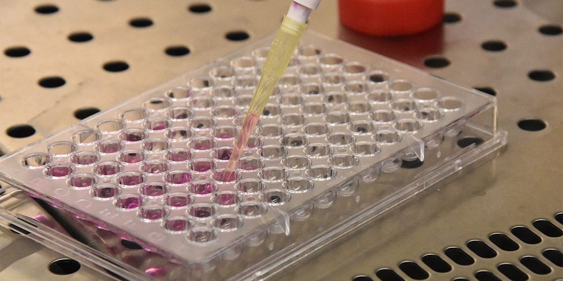 Sivas Cumhuriyet Üniversitesi Fen Fakültesi, Moleküler Biyoloji ve Genetik Bölümü Öğretim Üyesi Prof. Dr. Birnur Akkaya'dan kanser hücrelerinin yayılmasını önleyecek çalışma; patentini aldı