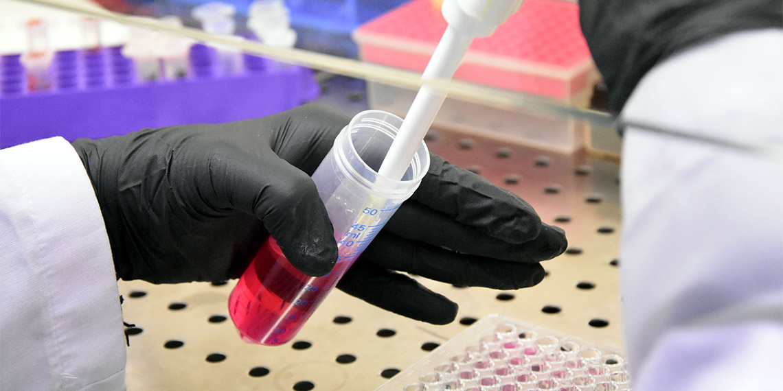 Türk profesörden kanser hücrelerinin yayılmasını önleyecek çalışma