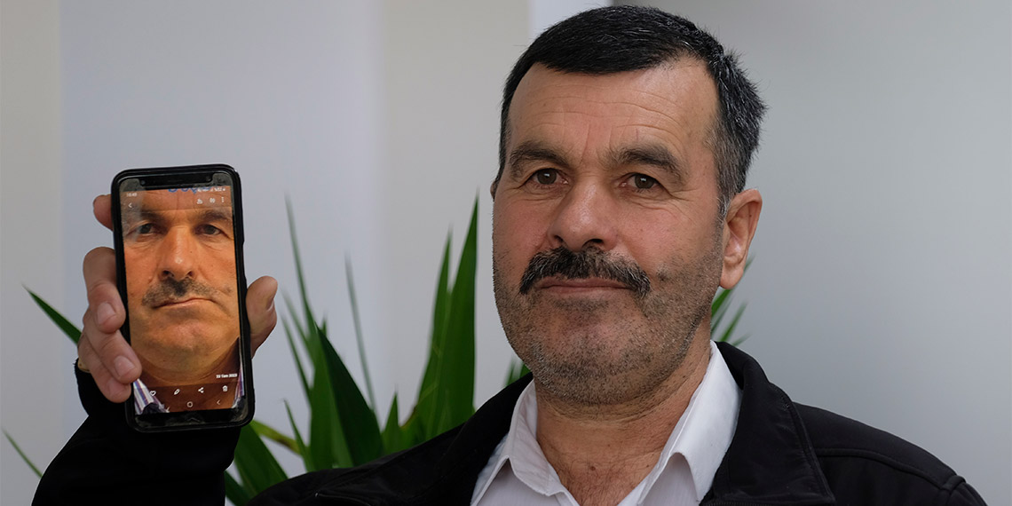 Necmettin Erbakan Üniversitesi Ağız, Diş ve Çene Cerrahisi'ne başvuran 2 hastadaki sebebi bilinmeyen ağrı ve yüz bozulmasının nedeni tümör çıktı.