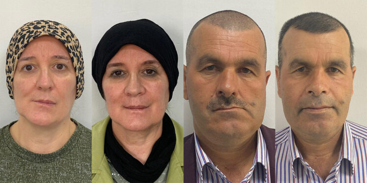 2 hastadaki ağrı ve yüz bozulmasının nedeni tümör çıktı