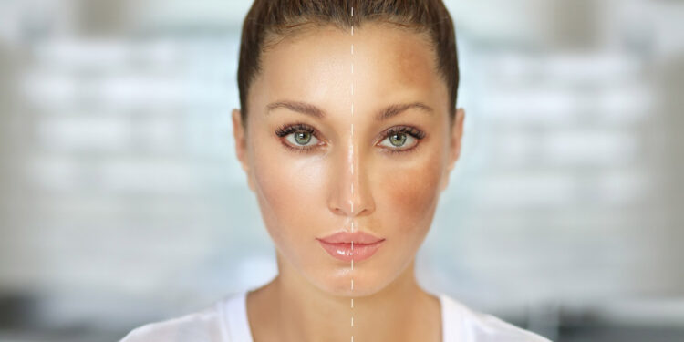 Bazı hastalıklar da cilt lekelerine yol açabilir