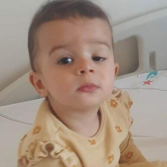 Beste bebek, göz kapağı kaldırma ameliyatı ile sağlığına kavuştu