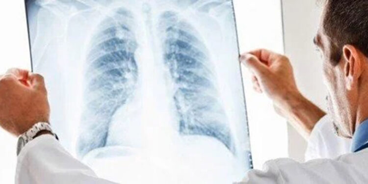 EBUS yöntemi, akciğer hastalıklarında cerrahiye alternatif oluyor
