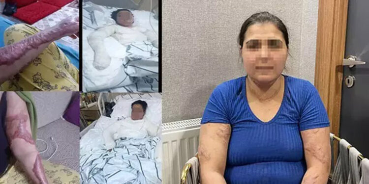 Eşi ve kayınbiraderi, üzerine kolonya döküp yakmaya çalıştı