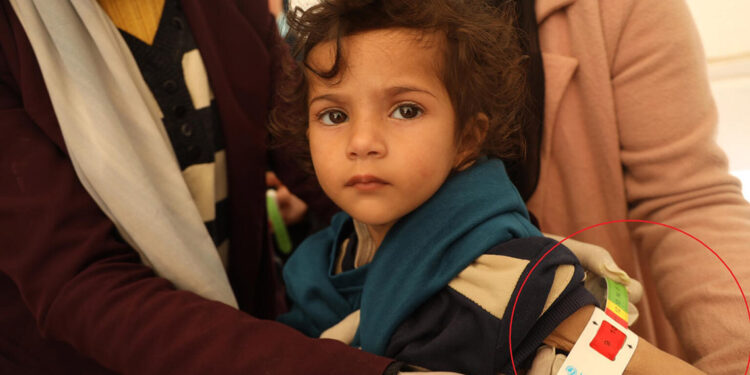 Gazzeli çocuklar yetersiz besleniyor, hayatları tehlikede