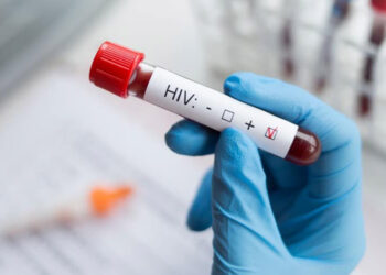 HIV virüsü, bazı kanser türlerine yol açabilir