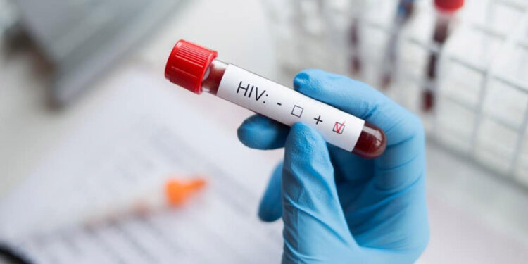 HIV virüsü, bazı kanser türlerine yol açabilir