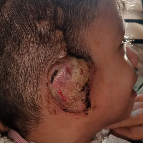 Kulağından ameliyat edilen Kaan’ın ailesinden yanlış tedavi iddiası