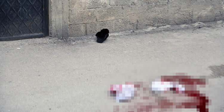 Sokakta tartıştığı kızını bıçaklayıp ağır yaraladı