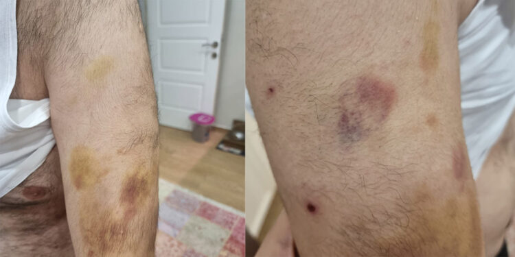 'Otizmli öğrenciyi öğretmeni darbetti' iddiası