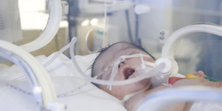 Bebeğin ağzını kaplayan kitle ameliyatla alındı