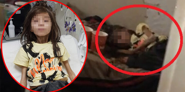 Çöp evde alıkonulan çocuğa kan donduran işkenceler