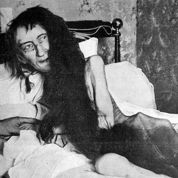 Blanche Monnier'in sıra dışı acı hikayesi