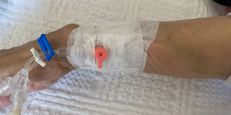 Damar yolu ile verilen serumda mikroplastik çıktı