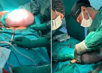 Karnından 10 kiloluk kitle çıktı