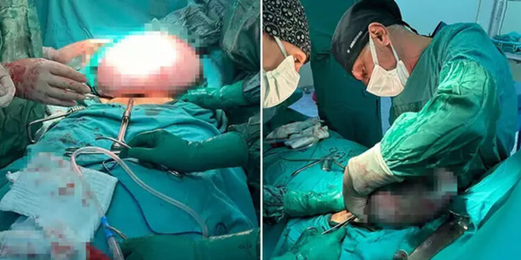 Karnından 10 kiloluk kitle çıktı 