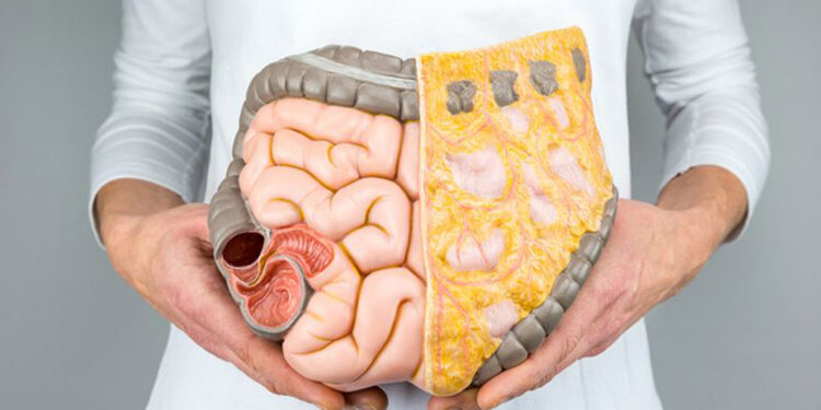 Kolon kanseri riskine karşı günlük en az 150 kalori yakın