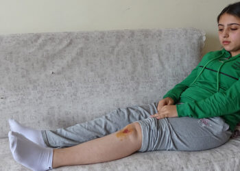 Köpeklerin saldırısına uğrayan liseli Özge yaralandı