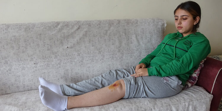 Köpeklerin saldırısına uğrayan liseli Özge yaralandı